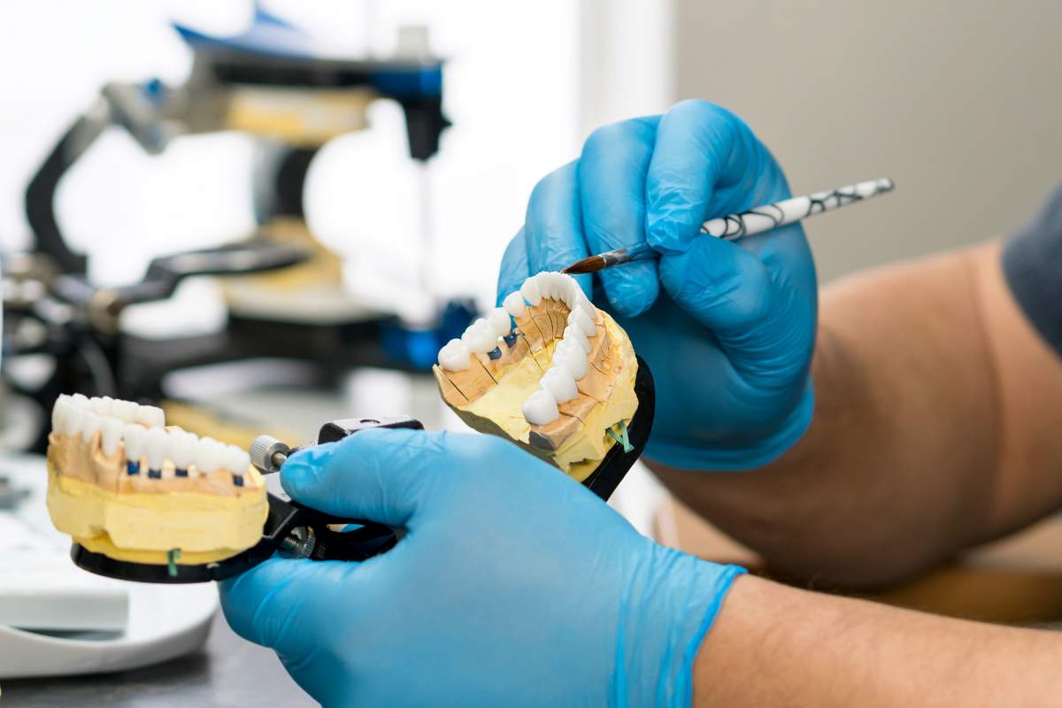 Proteza szkieletowa – metalowa konstrukcja protetyczna w stomatologii